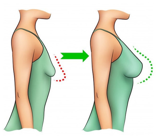 breastaugmentation